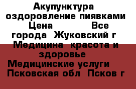 Акупунктура, оздоровление пиявками › Цена ­ 3 000 - Все города, Жуковский г. Медицина, красота и здоровье » Медицинские услуги   . Псковская обл.,Псков г.